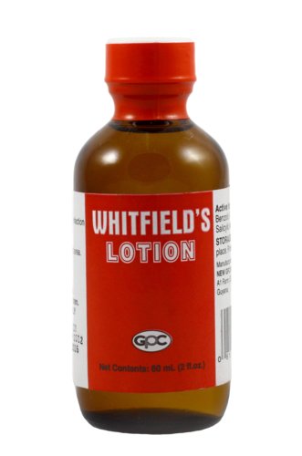 GPC WHITFIELD'S LOTION & OINTMENT 60ML - Uplift Things